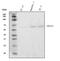 Programmed Cell Death 1 antibody, A00178, Boster Biological Technology, Western Blot image 