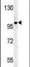 ST18 C2H2C-Type Zinc Finger Transcription Factor antibody, PA5-25295, Invitrogen Antibodies, Western Blot image 