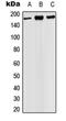 PH Domain And Leucine Rich Repeat Protein Phosphatase 1 antibody, orb215555, Biorbyt, Western Blot image 