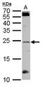 Regulator Of G Protein Signaling 4 antibody, LS-C186350, Lifespan Biosciences, Western Blot image 