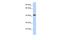 Kaptin, Actin Binding Protein antibody, A12065, Boster Biological Technology, Western Blot image 