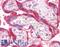 Interleukin 1 Receptor Associated Kinase 1 antibody, LS-B4360, Lifespan Biosciences, Immunohistochemistry paraffin image 