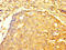 Tripartite Motif Containing 74 antibody, LS-C377991, Lifespan Biosciences, Immunohistochemistry paraffin image 