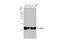 Small Nuclear Ribonucleoprotein Polypeptide E antibody, GTX129801, GeneTex, Western Blot image 