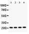 Fms Related Tyrosine Kinase 3 Ligand antibody, PA5-79272, Invitrogen Antibodies, Western Blot image 