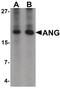 Angiogenin antibody, PA5-34422, Invitrogen Antibodies, Western Blot image 