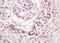 Cellular Communication Network Factor 3 antibody, orb101862, Biorbyt, Immunohistochemistry paraffin image 