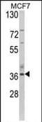 Aspartoacylase antibody, PA5-35320, Invitrogen Antibodies, Western Blot image 