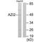 5-Azacytidine Induced 2 antibody, A08235, Boster Biological Technology, Western Blot image 
