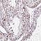 Zinc Finger Protein 689 antibody, PA5-62916, Invitrogen Antibodies, Immunohistochemistry paraffin image 