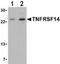 TNF Receptor Superfamily Member 14 antibody, ab47677, Abcam, Western Blot image 
