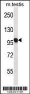 VHL-interacting deubiquitinating enzyme 2 antibody, 61-111, ProSci, Western Blot image 