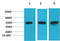 Mitogen-Activated Protein Kinase Kinase 2 antibody, GTX34071, GeneTex, Western Blot image 