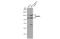 RNA Binding Motif Protein 10 antibody, GTX115074, GeneTex, Western Blot image 