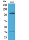 Tumor Protein P73 antibody, STJ96708, St John