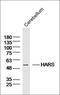 Histidyl-TRNA Synthetase antibody, orb317628, Biorbyt, Western Blot image 