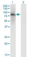 Zinc Finger Protein 41 antibody, H00007592-M01, Novus Biologicals, Western Blot image 