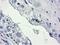 Haloacid Dehalogenase Like Hydrolase Domain Containing 2 antibody, LS-C785989, Lifespan Biosciences, Immunohistochemistry paraffin image 