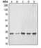 ES Cell Expressed Ras antibody, LS-C352322, Lifespan Biosciences, Western Blot image 