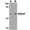 SNW Domain Containing 1 antibody, MBS150270, MyBioSource, Western Blot image 
