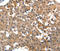 Glutamate Metabotropic Receptor 1 antibody, LS-C332304, Lifespan Biosciences, Immunohistochemistry paraffin image 