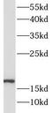 Superoxide Dismutase 1 antibody, FNab09989, FineTest, Western Blot image 