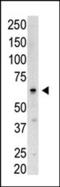 SUMO Specific Peptidase 3 antibody, MBS9209863, MyBioSource, Western Blot image 