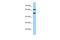 ArfGAP With FG Repeats 2 antibody, A16126, Boster Biological Technology, Western Blot image 