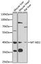 Mitochondrially Encoded NADH:Ubiquinone Oxidoreductase Core Subunit 2 antibody, 22-042, ProSci, Western Blot image 