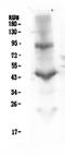 Integrin Subunit Beta 2 antibody, M00458-1, Boster Biological Technology, Western Blot image 