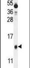 Protein BEX1 antibody, PA5-24192, Invitrogen Antibodies, Western Blot image 