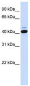 SMYD Family Member 5 antibody, TA339695, Origene, Western Blot image 