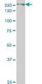 Eukaryotic Translation Initiation Factor 4 Gamma 1 antibody, H00001981-M10, Novus Biologicals, Western Blot image 