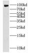 Fragile X mental retardation syndrome-related protein 2 antibody, FNab03257, FineTest, Western Blot image 