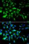 MYD88 Innate Immune Signal Transduction Adaptor antibody, LS-C331180, Lifespan Biosciences, Immunofluorescence image 