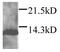 Dap12 antibody, GTX45097, GeneTex, Western Blot image 