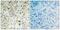 RB Transcriptional Corepressor 1 antibody, GTX50192, GeneTex, Immunohistochemistry paraffin image 