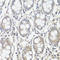 Protein Tyrosine Kinase 2 antibody, LS-C746908, Lifespan Biosciences, Immunohistochemistry frozen image 