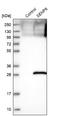 SUMO Peptidase Family Member, NEDD8 Specific antibody, NBP1-85259, Novus Biologicals, Western Blot image 