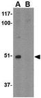 Formin Binding Protein 1 Like antibody, GTX85425, GeneTex, Western Blot image 