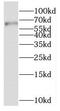 Thiamine transporter 2 antibody, FNab07915, FineTest, Western Blot image 