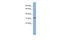 Small Nuclear RNA Activating Complex Polypeptide 2 antibody, 25-010, ProSci, Enzyme Linked Immunosorbent Assay image 