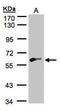 Glycerol Kinase 2 antibody, PA5-28598, Invitrogen Antibodies, Western Blot image 