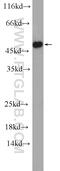 Diacylglycerol O-Acyltransferase 1 antibody, 11561-1-AP, Proteintech Group, Western Blot image 