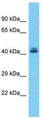 Zinc Finger And SCAN Domain Containing 5A antibody, TA345385, Origene, Western Blot image 