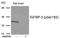 Insulin Like Growth Factor Binding Protein 3 antibody, AP55946PU-S, Origene, Western Blot image 