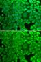 Glycogen Synthase 1 antibody, GTX55642, GeneTex, Immunocytochemistry image 