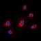 Midline 1 antibody, orb338841, Biorbyt, Immunocytochemistry image 