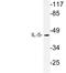 Interleukin 5 antibody, LS-B14355, Lifespan Biosciences, Western Blot image 