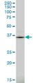 PDZ And LIM Domain 1 antibody, LS-C133993, Lifespan Biosciences, Western Blot image 